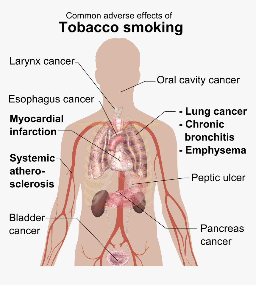 Adverse Effects Of Tobacco Smoking - Disease From Cigarette Smoking