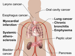Adverse Effects Of Tobacco Smoking - Disease From Cigarette Smoking
