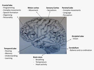 Functions Of Areas Of The Human Brain - Human Brain With Dementia