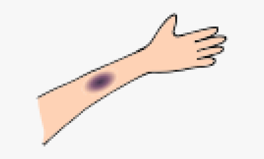 Bruises Cliparts - Marking Tools