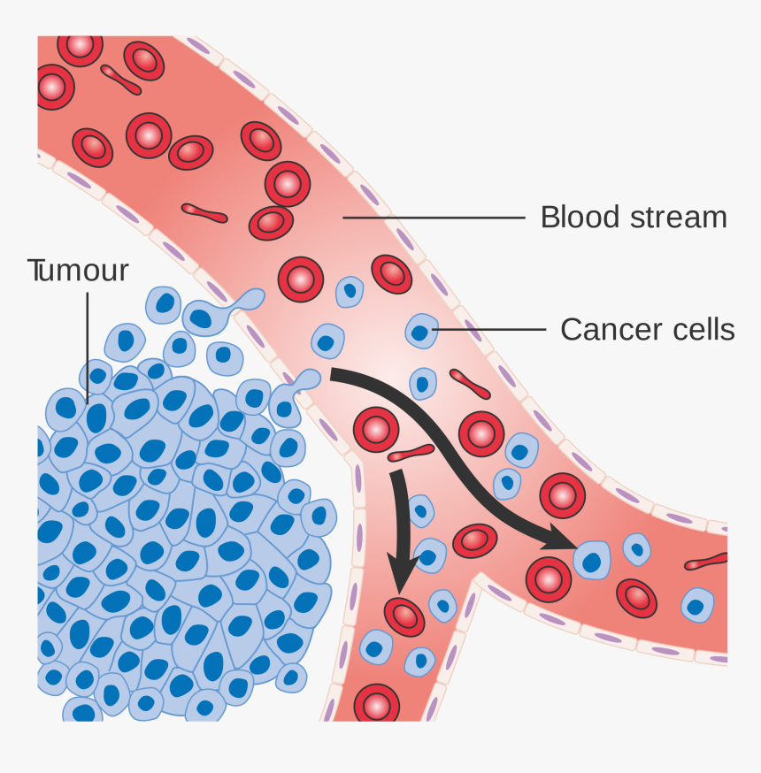 Do Cancer Cells Spread