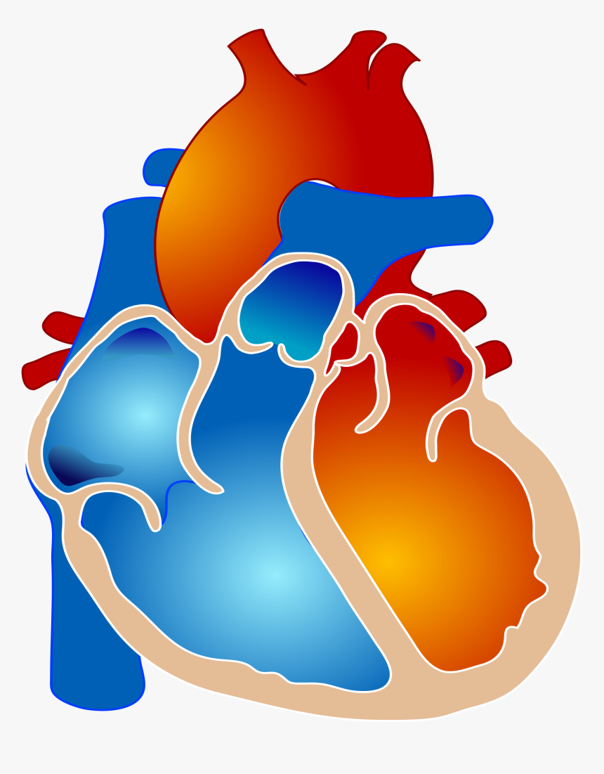 Pulmonary Atresia With Single Ventricle Clipart 