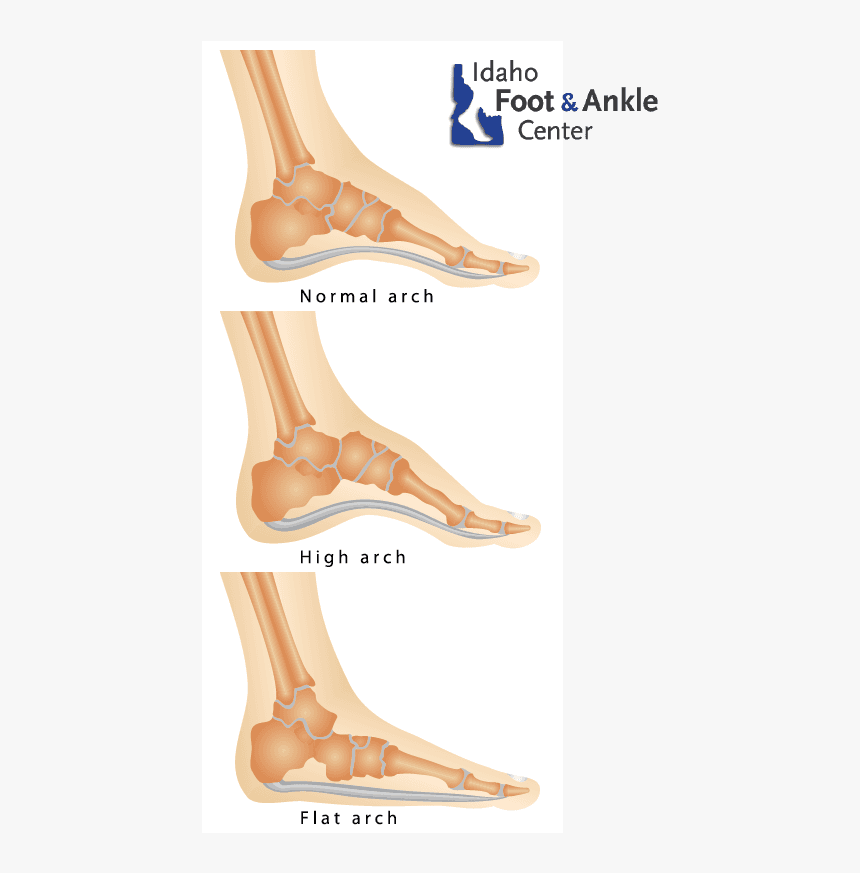 Flat Feet & Other Foot Deformiti